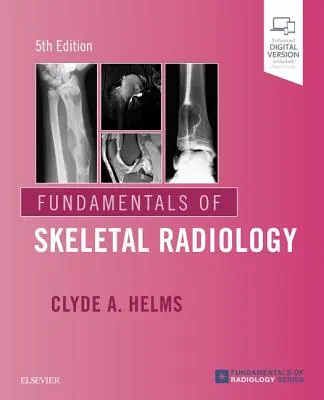 Grundlagen der Skelettradiologie - Fundamentals of Skeletal Radiology