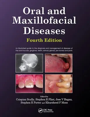 Mund-, Kiefer- und Gesichtskrankheiten, Vierte Auflage - Oral and Maxillofacial Diseases, Fourth Edition