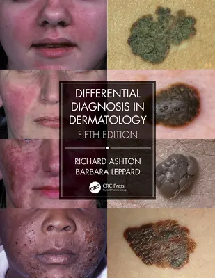 Differentialdiagnose in der Dermatologie - Differential Diagnosis in Dermatology