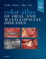 Farbatlas der Mund-, Kiefer- und Gesichtskrankheiten - Color Atlas of Oral and Maxillofacial Diseases