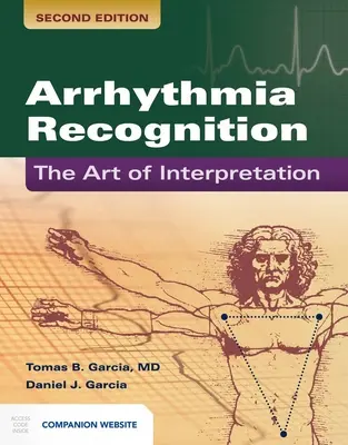 Arrhythmie-Erkennung: Die Kunst der Interpretation: Die Kunst der Interpretation - Arrhythmia Recognition: The Art of Interpretation: The Art of Interpretation