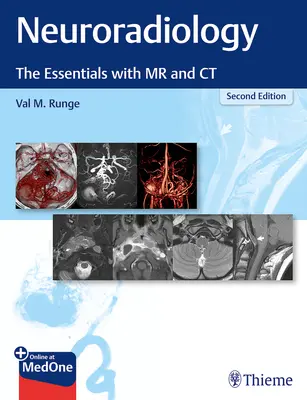 Neuroradiologie: Die Grundlagen mit MR und CT - Neuroradiology: The Essentials with MR and CT