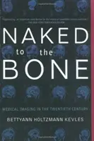 Nackt bis auf die Knochen: Medizinische Bildgebung im zwanzigsten Jahrhundert - Naked to the Bone: Medical Imaging in the Twentieth Century