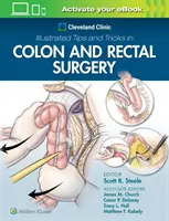 Cleveland Clinic Illustrierte Tipps und Tricks in der Dickdarm- und Enddarmchirurgie - Cleveland Clinic Illustrated Tips and Tricks in Colon and Rectal Surgery