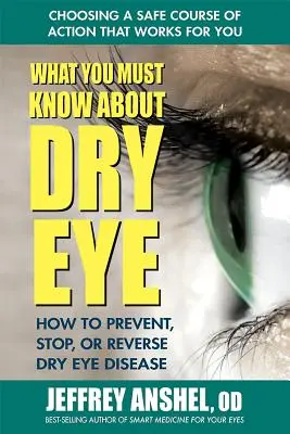 Was Sie über trockene Augen wissen müssen: Wie Sie die Krankheit verhindern, stoppen oder umkehren können - What You Must Know about Dry Eye: How to Prevent, Stop, or Reverse Dry Eye Disease