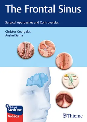 Der Sinus frontalis: Chirurgische Ansätze und Kontroversen - The Frontal Sinus: Surgical Approaches and Controversies