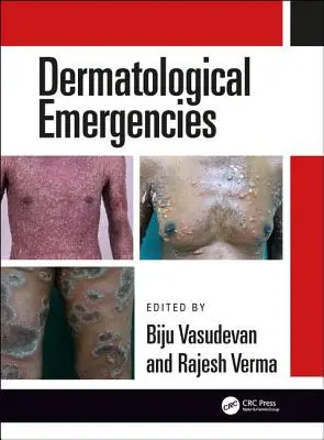 Dermatologische Notfälle - Dermatological Emergencies