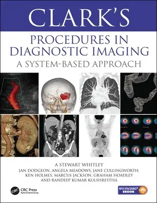 Clarks Verfahren in der diagnostischen Bildgebung - Ein systembasierter Ansatz - Clark's Procedures in Diagnostic Imaging - A System-Based Approach