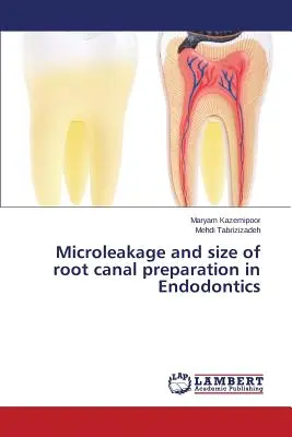 Mikroleckage und Größe der Wurzelkanalaufbereitung in der Endodontie - Microleakage and size of root canal preparation in Endodontics