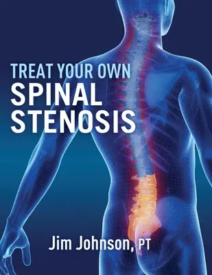 Behandeln Sie Ihre eigene Spinalkanalstenose - Treat Your Own Spinal Stenosis