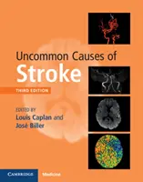 Ungewöhnliche Ursachen des Schlaganfalls - Uncommon Causes of Stroke