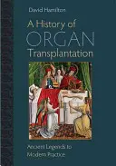 Eine Geschichte der Organtransplantation: Antike Legenden und moderne Praxis - A History of Organ Transplantation: Ancient Legends to Modern Practice