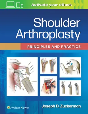 Schulterarthroplastik: Prinzipien und Praxis - Shoulder Arthroplasty: Principles and Practice