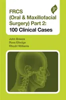 Frcs (Mund-, Kiefer- und Gesichtschirurgie) Teil 2: 100 klinische Fälle - Frcs (Oral & Maxillofacial Surgery) Part 2: 100 Clinical Cases