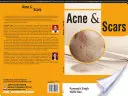 ACNE und SCARS - ACNE and SCARS