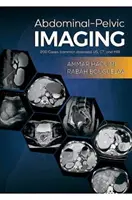 Abdominal-Becken-Bildgebung - 200 Fälle (häufige Krankheiten): US, CT und MRT - Abdominal-Pelvic Imaging - 200 Cases (Common Diseases): US, CT and MRI