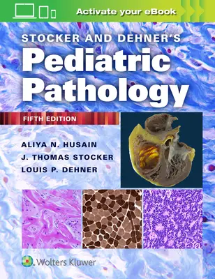 Stocker und Dehner's Pädiatrische Pathologie - Stocker and Dehner's Pediatric Pathology