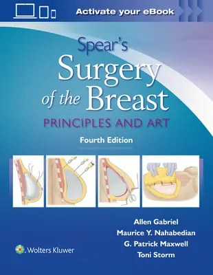 Spear's Chirurgie der Brust: Prinzipien und Kunst - Spear's Surgery of the Breast: Principles and Art