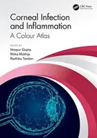 Hornhautinfektionen und -entzündungen: Ein Farbatlas - Corneal Infection and Inflammation: A Colour Atlas