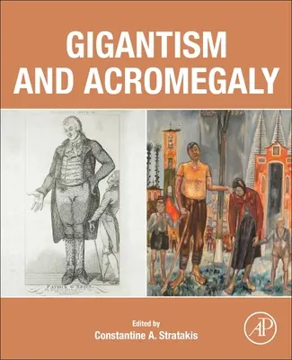 Gigantismus und Akromegalie - Gigantism and Acromegaly