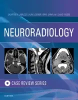 Neuroradiologische Bildgebung Fallbesprechung - Neuroradiology Imaging Case Review