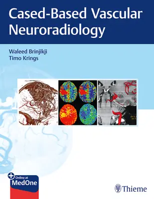 Bildgebung bei neurovaskulären Erkrankungen: Ein fallbasierter Ansatz - Imaging in Neurovascular Disease: A Case-Based Approach