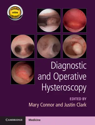 Diagnostische und operative Hysteroskopie - Diagnostic and Operative Hysteroscopy