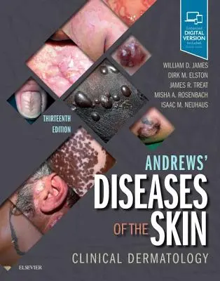 Andrews' Diseases of the Skin: Klinische Dermatologie - Andrews' Diseases of the Skin: Clinical Dermatology