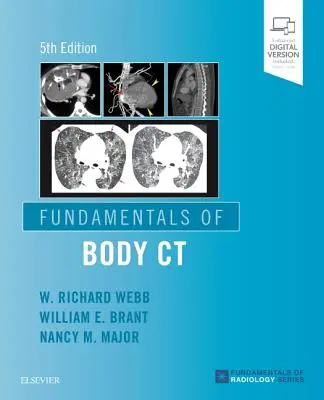 Grundlagen der Körper-CT - Fundamentals of Body CT