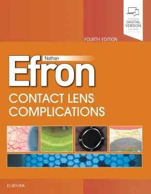 Komplikationen bei Kontaktlinsen - Contact Lens Complications