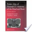 Pocket Atlas of Normal CT Anatomy of the Head and Brain