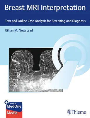 MRT-Interpretation der Brust: Text und Online-Fallanalyse für Screening und Diagnostik - Breast MRI Interpretation: Text and Online Case Analysis for Screening and Diagnosis
