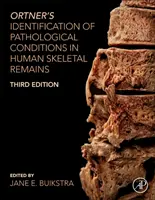 Ortners Identifizierung von pathologischen Zuständen in menschlichen Skelettresten - Ortner's Identification of Pathological Conditions in Human Skeletal Remains