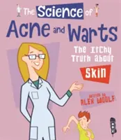 Die Wissenschaft von Akne und Warzen - die juckende Wahrheit über die Haut - Science Of Acne & Warts - The Itchy Truth About Skin