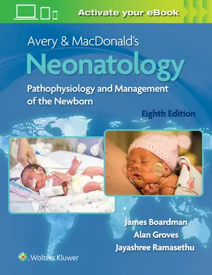 Avery & Macdonalds Neonatologie: Pathophysiologie und Management des Neugeborenen - Avery & Macdonald's Neonatology: Pathophysiology and Management of the Newborn