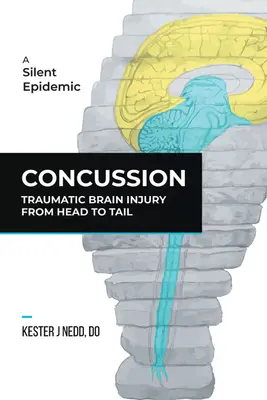 Gehirnerschütterung: Traumatische Hirnverletzungen von Kopf bis Fuß - Concussion: Traumatic Brain Injury from Head to Tail
