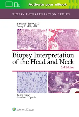 Interpretation der Biopsie von Kopf und Hals - Biopsy Interpretation of the Head and Neck