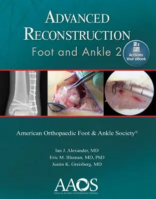 Fortgeschrittene Rekonstruktion: Fuß und Sprunggelenk 2: Print + eBook - Advanced Reconstruction: Foot and Ankle 2: Print + eBook