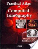 Praktischer Atlas der Computertomographie - Practical Atlas of Computed Tomography