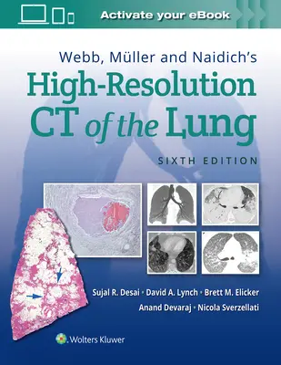 Das hochauflösende CT der Lunge von Webb, Mller und Naidich - Webb, Mller and Naidich's High-Resolution CT of the Lung