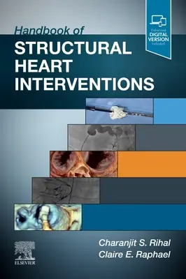 Handbuch der strukturellen Herzinterventionen - Handbook of Structural Heart Interventions