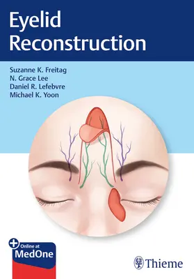 Augenlid-Rekonstruktion - Eyelid Reconstruction