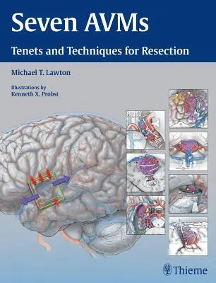 Sieben Avms: Lehren und Techniken der Resektion - Seven Avms: Tenets and Techniques for Resection