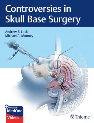 Kontroversen in der Schädelbasischirurgie - Controversies in Skull Base Surgery