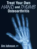 Behandeln Sie Ihre eigene Arthrose in Hand und Daumen - Treat Your Own Hand and Thumb Osteoarthritis