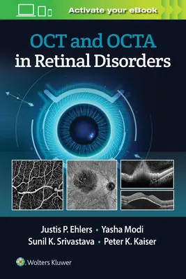 Oct und Octa bei Netzhauterkrankungen - Oct and Octa in Retinal Disorders