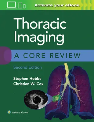 Thorakale Bildgebung: Eine grundlegende Überprüfung - Thoracic Imaging: A Core Review