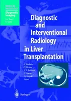 Diagnostische und Interventionelle Radiologie in der Lebertransplantation - Diagnostic and Interventional Radiology in Liver Transplantation