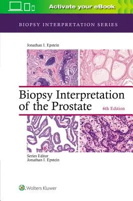 Biopsieauswertung der Prostata - Biopsy Interpretation of the Prostate