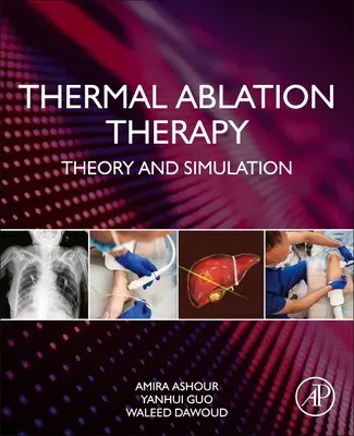 Thermische Ablationstherapie: Theorie und Simulation - Thermal Ablation Therapy: Theory and Simulation